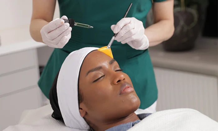 Kemisk peeling Utbildning